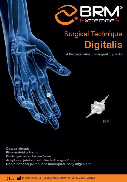 Implant interfalangian PIP din silicon( Chirurgie Plastica, Ortopedie)