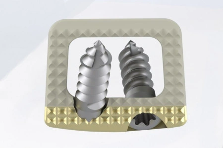 TITANOPEEK - Cage Vertebral Cervical cu suruburi de prindere si profil anatomic