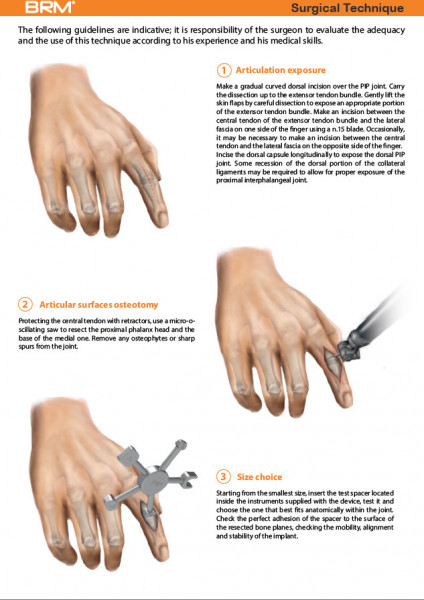 Implant interfalangian PIP din silicon( Chirurgie Plastica, Ortopedie)