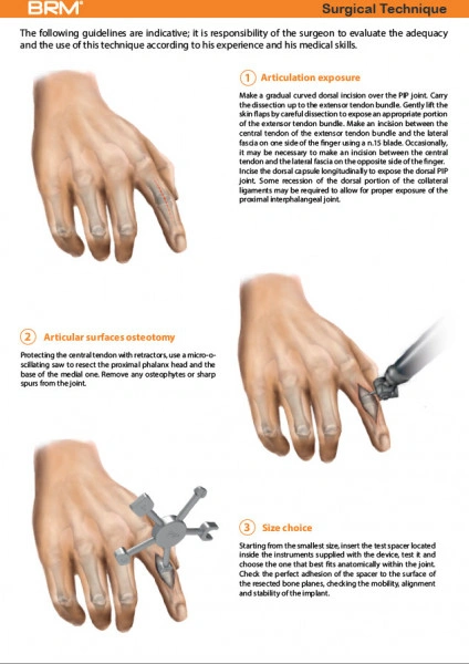 Implant interfalangian PIP din silicon( Chirurgie Plastica, Ortopedie)