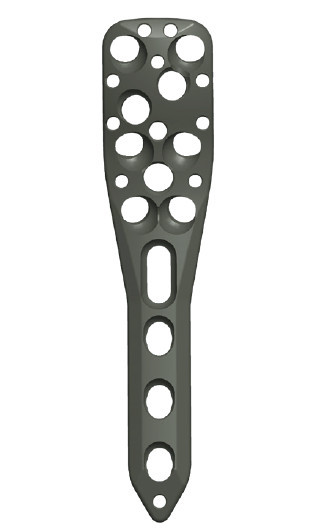 Placa Humerus Proximal poliaxiala pentru osteointeza fracturii de Humerus