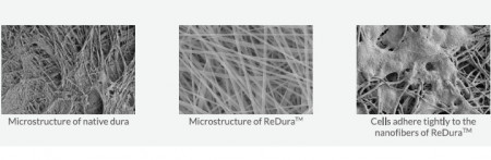 Substituent dural ReDura Enlife