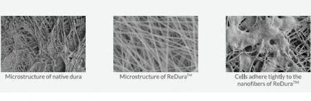 Substituent dural ReDura Enlife