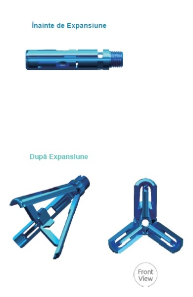 TRIPOD-FIX – Sistem Expandabil Vertebral pentru Fracturi de Compresie | Augmentare cu PMMA - Img 5