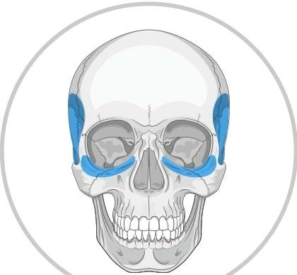 Implanturi Personalizate pentru Augmentarea Feței și Craniului | Chirurgie Plastică și Estetică, MEDPRIN - Img 3