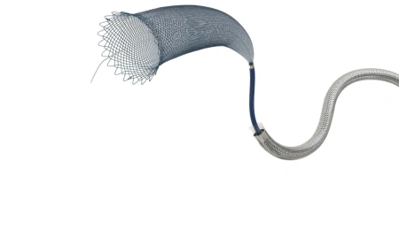 Kylin™ – Flow Diverter Intracranian pentru Tratamentul Anevrismelor | Optimed | Zylox-Tonbridge - Img 3