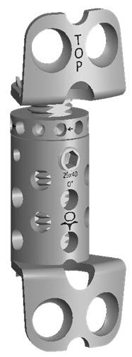 X-MESH EXPANDABLE ANTERIOR CERVICAL CORPECTOMY CAGE - Img 4