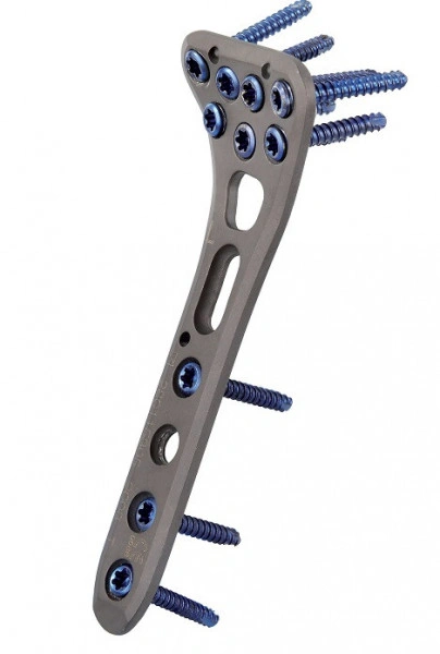 Placa de Radius Distal poliaxiala pentru osteointeza fracturii de radius
