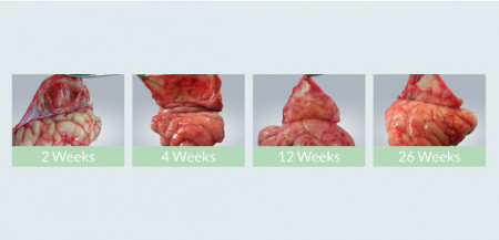 Substituent dural NeoDura Enlife