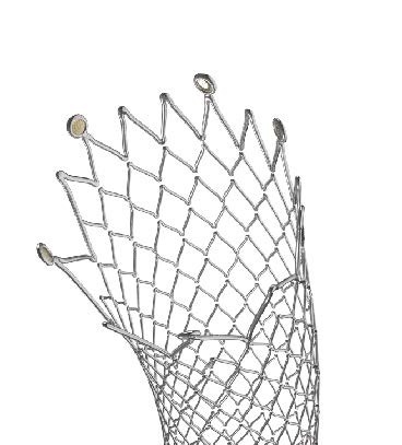 ZENFLEX™ – Stent Periferic Autoexpandabil Nitinol | Zylox-Tonbridge - Img 2