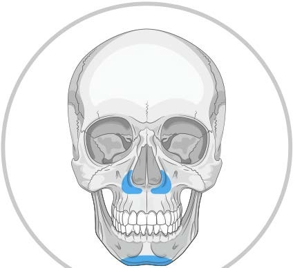 Implanturi Personalizate pentru Augmentarea Feței și Craniului | Chirurgie Plastică și Estetică - Img 4