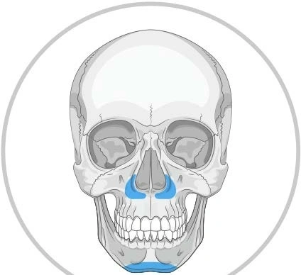 Implanturi Personalizate pentru Augmentarea Feței și Craniului | Chirurgie Plastică și Estetică, MEDPRIN - Img 4