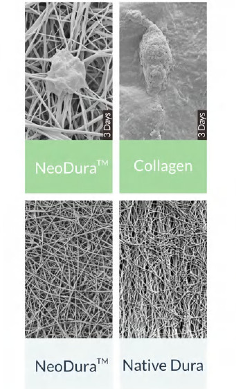 Substituent dural NeoDura Enlife