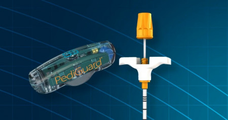 Dispozitiv de monitorizare  in timp real - PediGuard (Canulat)