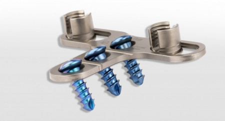 PORTHOS POSTERIOR CERVICAL SPINAL FIXATION SYSTEM - Img 2