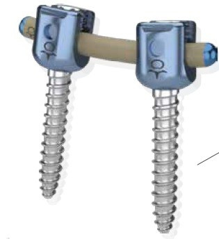 Sistem de Fixare Spinală Posterioră – Soluție Modulară pentru Traumă și Oncologie