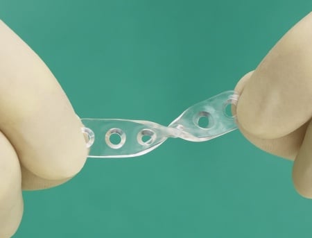 Sistem resorbabil pentru craniostenoză (craniosinostoză) – Inion CPS® Baby (Inion, Finlanda) - Img 2