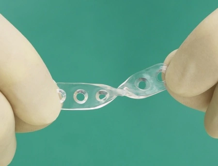 Sistem resorbabil pentru craniostenoză (craniosinostoză) – Inion CPS® Baby (Inion, Finlanda) - Img 2