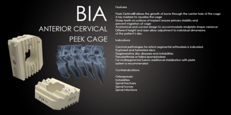 Hernie de Disc Cervicala, Cage Cervical din PEEK Bia