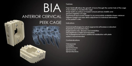 Hernie de Disc Cervicala, Cage Cervical din PEEK Bia