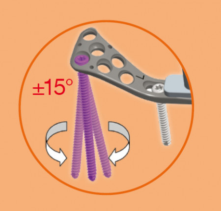 Placa de tibie proximala poliaxiala pentru osteosinteza fracturii de tibie Enlife