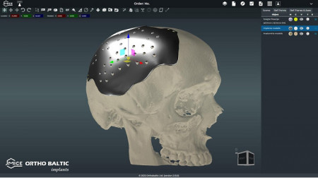 Platforma MICE – Planificare pre-chirurgicală 3D cu inteligență artificială | Implanturi personalizate