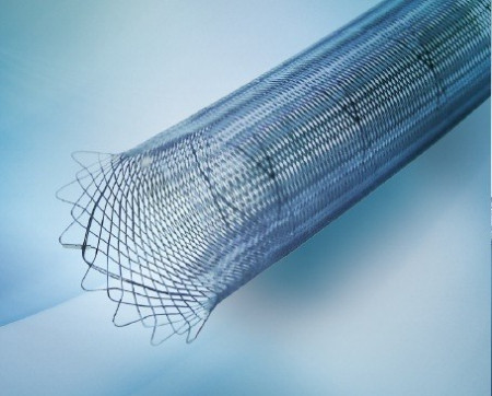DERIVO, dispozitiv de ebmolizare (Flow Diverter) tratarea anevrismului intracran
