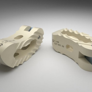 FIDES – Cage PEEK TLIF cu Fixare Anatomică pentru Chirurgia Lombară