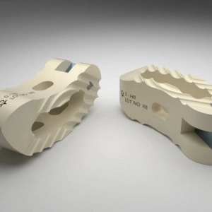 FIDES – Cage PEEK TLIF cu Fixare Anatomică pentru Chirurgia Lombară