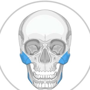 Implanturi Personalizate pentru Augmentarea Feței și Craniului | Chirurgie Plastică și Estetică - Img 5
