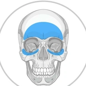 Implanturi Personalizate pentru Augmentarea Feței și Craniului | Chirurgie Plastică și Estetică, MEDPRIN - Img 2