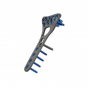 Placă Radius Distal – Fixare Volară Anatomică Poliaxială | Sistem Vortex