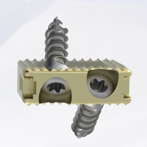 TITANOPEEK - Cage Vertebral Cervical cu suruburi de prindere si profil anatomic