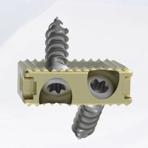 TITANOPEEK - Cage Vertebral Cervical cu suruburi de prindere si profil anatomic