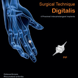 Implant interfalangian PIP din silicon( Chirurgie Plastica, Ortopedie)