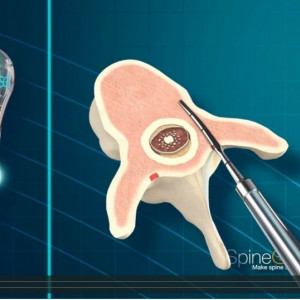 PediGuard® Curbat – Dispozitiv de Monitorizare Neuronală în Timp Real cu Vârf Direcționat - Img 2