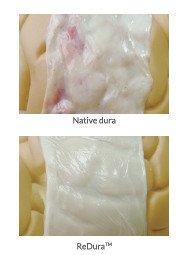 Substituent dural ReDura Enlife 