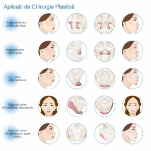 Implanturi Personalizate pentru Augmentarea Feței și Craniului | Chirurgie Plastică și Estetică
