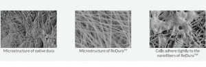 Substituent dural ReDura Enlife 