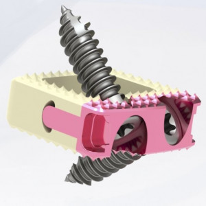 Cage Cervical TitanoPEEK-C cu suruburi de prindere si profil anatomic