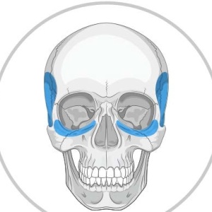 Implanturi Personalizate pentru Augmentarea Feței și Craniului | Chirurgie Plastică și Estetică - Img 3