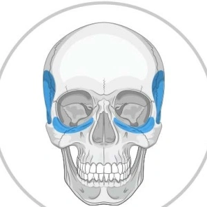 Implanturi Personalizate pentru Augmentarea Feței și Craniului | Chirurgie Plastică și Estetică, MEDPRIN - Img 3
