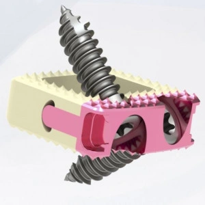 TITANOPEEK STAND ALONE CERVICAL CAGE SYSTEM