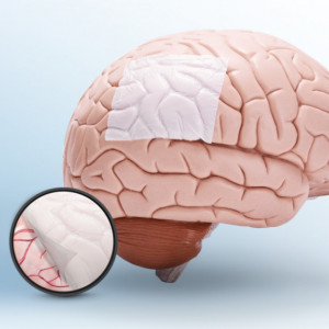 Substituent dural NeoDura Enlife