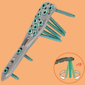 Placa Humerus Proximal poliaxiala pentru osteointeza fracturii de Humerus