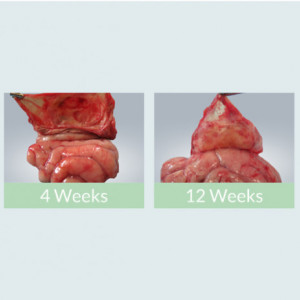 Substituent dural NeoDura Enlife