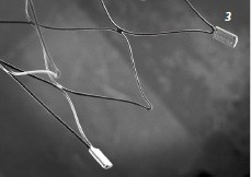 ACCERO, stent tipă braided  pentru tratamentul anevrismelor intracraniene.
