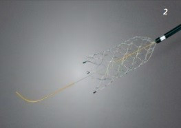 Stent intracranian autoexpandabil pentru LVO și ICAD – CREDO®