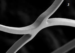 CREDO, Stent flexibil din Nitinol cu ​​auto-expandare pentru tratamentul stenozei intracraniene