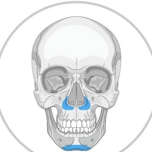 Implanturi Personalizate pentru Augmentarea Feței și Craniului | Chirurgie Plastică și Estetică - Img 4